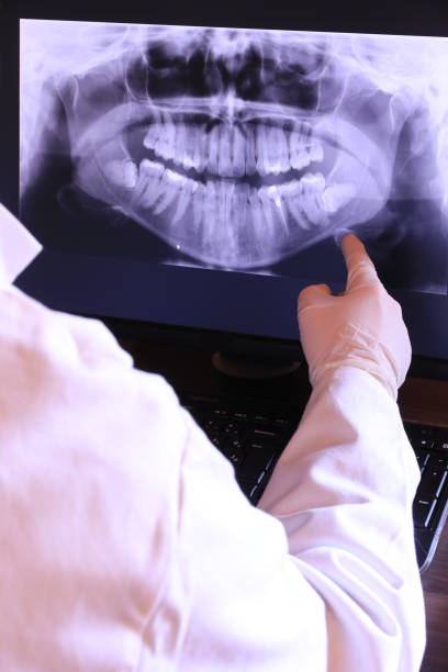 Best Emergency Root Canal Treatment in Bensville, MD