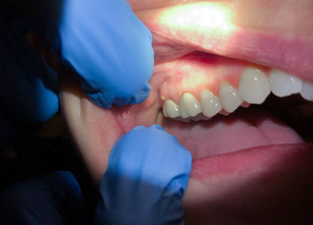 Best Weekend Emergency Dentist in Bensville, MD