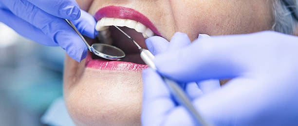 Best Emergency Wisdom Teeth Removal in Bensville, MD